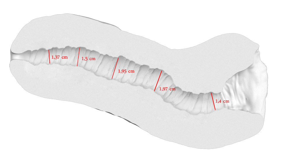 Keng ochilgan vagina